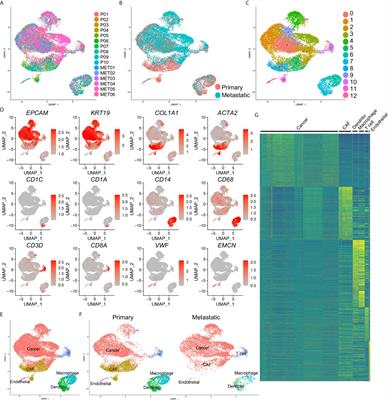 A Cancer Cell Cluster Marked by LincRNA MEG3 Leads Pancreatic Ductal Adenocarcinoma Metastasis